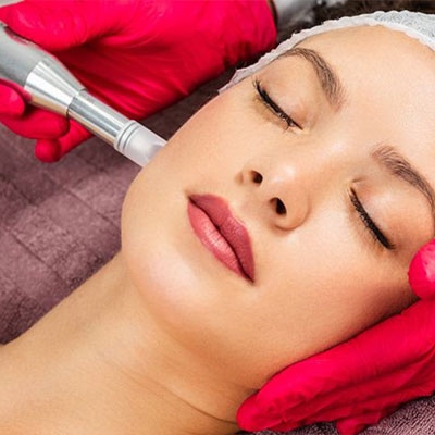 microneedling